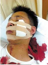 王老吉员工姚某脸部被加多宝员工郝某划伤